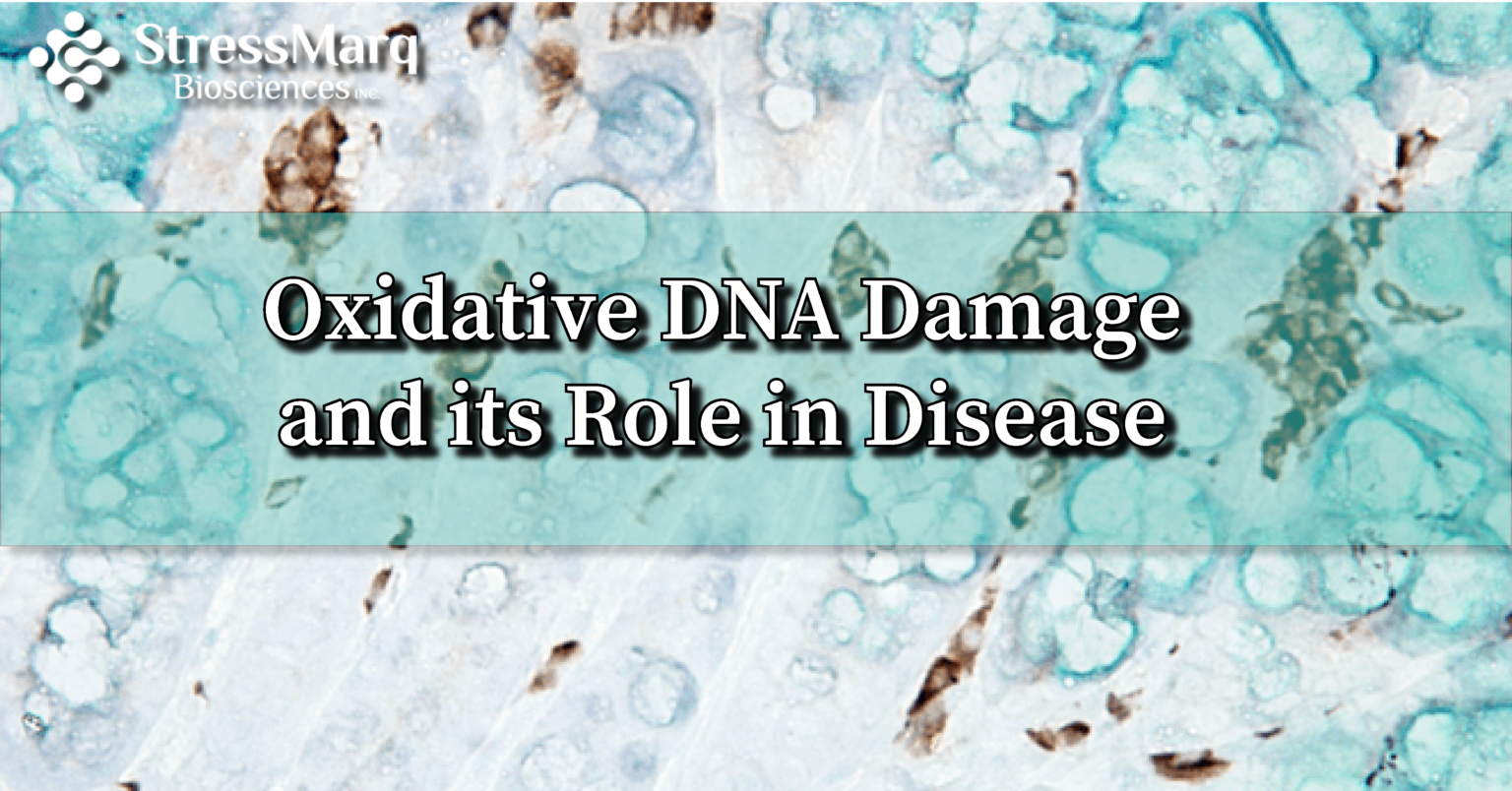 Oxidative DNA Damage and its Role in Disease | StressMarq