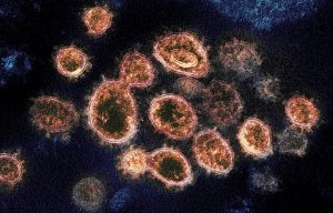 Novel_Coronavirus_SARS-CoV-2_