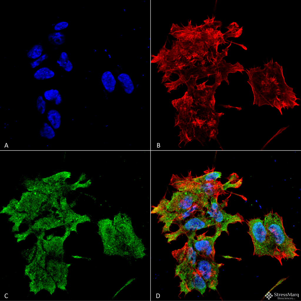 Alpha B Crystallin Antibody, Clone 3A10.H4