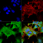 SMC-430_Notch1_Antibody_N253-32_ICC-IF_Human_Neuroblastoma-cell-line-SK-N-BE_60X_Composite-1.png