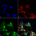 SMC-438_AMIGO-1_Antibody_L86-33_ICC-IF_Human_Neuroblastoma-cells-SH-SY5Y-Composite-1.png