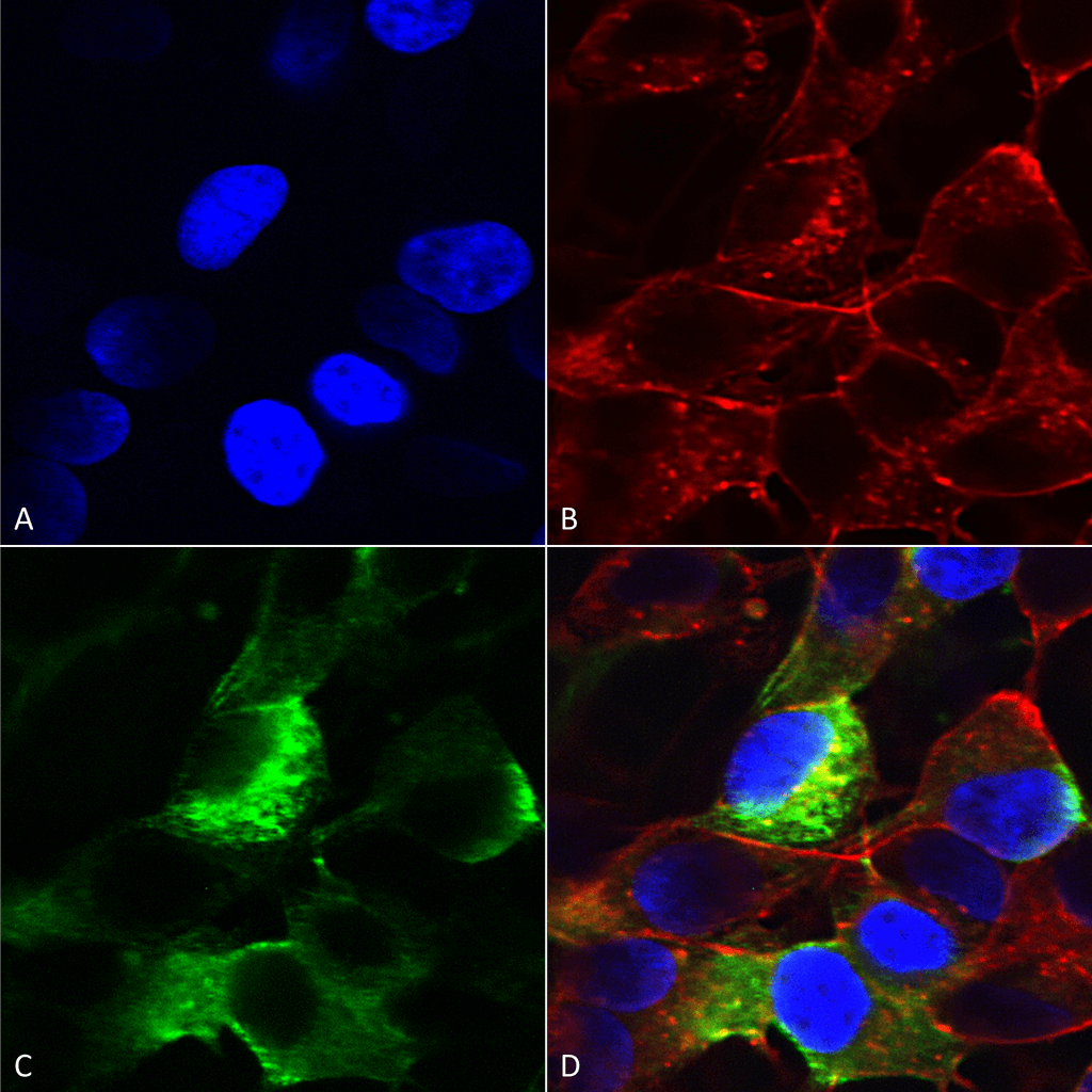 Anti-SCN3B Antibody [S396-29] Monoclonal IgG2B