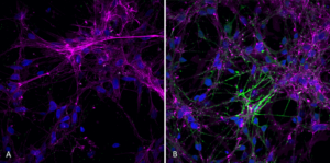 Rabbit Anti-Alpha Synuclein Antibody (pSer129) [J18] used in Immunocytochemistry/Immunofluorescence (ICC/IF) on Human iPSC-derived neurons (SMC-600)