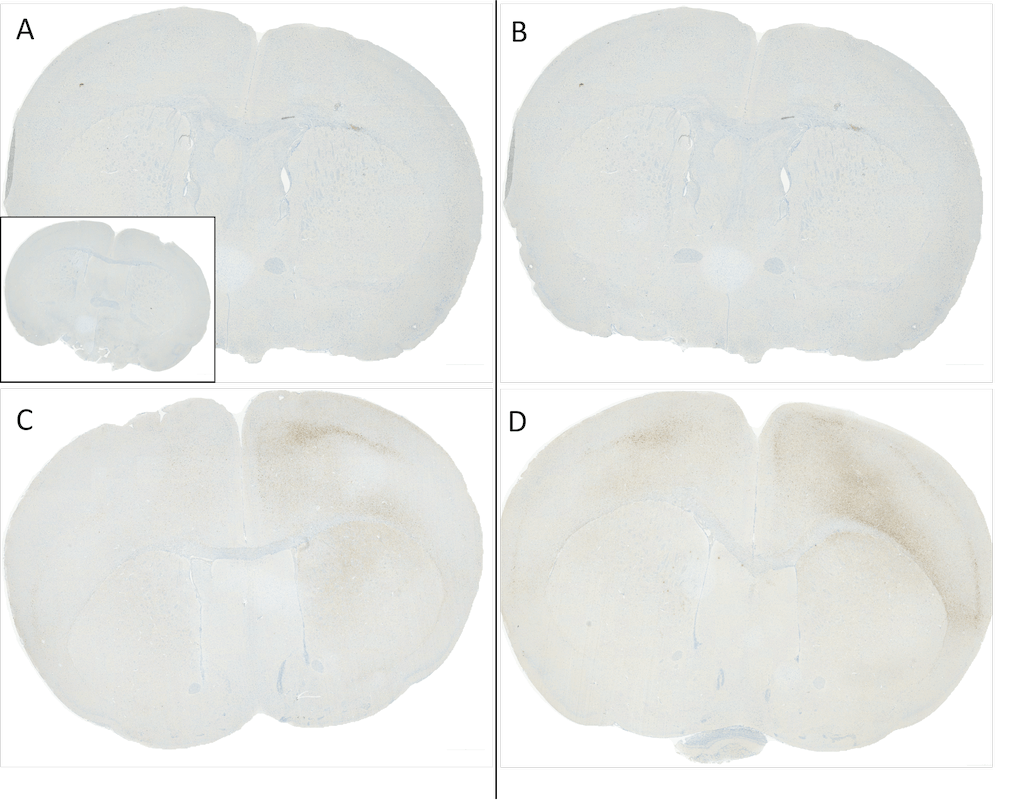 Alpha Synuclein Antibody (pSer129), Clone J18