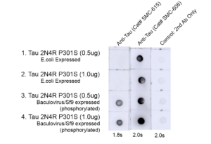 Mouse Anti-Tau Antibody (pThr217) [15B7] used in Dot Blot (DB) on Human, Mouse, Rat Tau 2N4R P301S (phospho & non-phospho) (SMC-615)